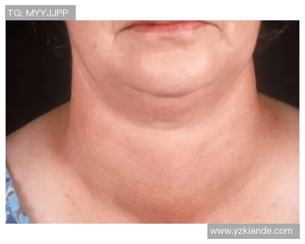 足球球星脖子粗的背后原因与运动员体型变化的深层解析